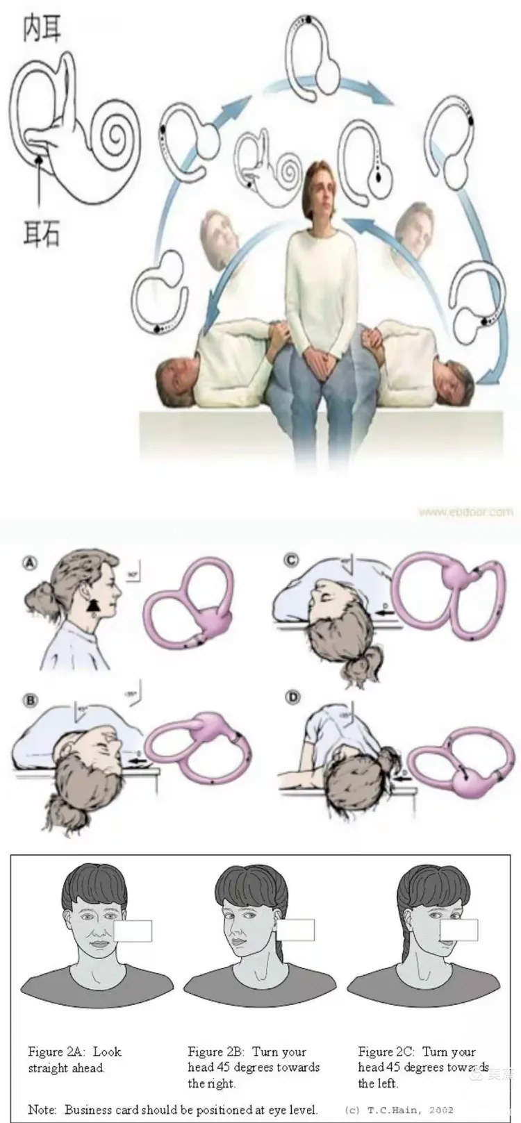 锻炼前庭功能 提升平衡力 ——远离眩晕